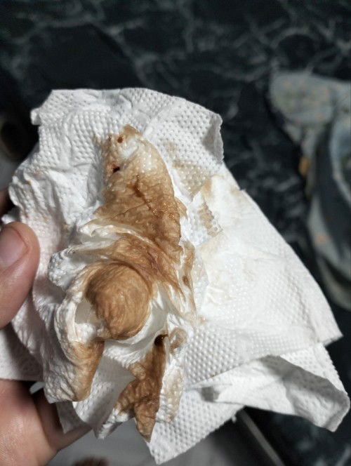 เลือดออกขณะตั้งครรภ์