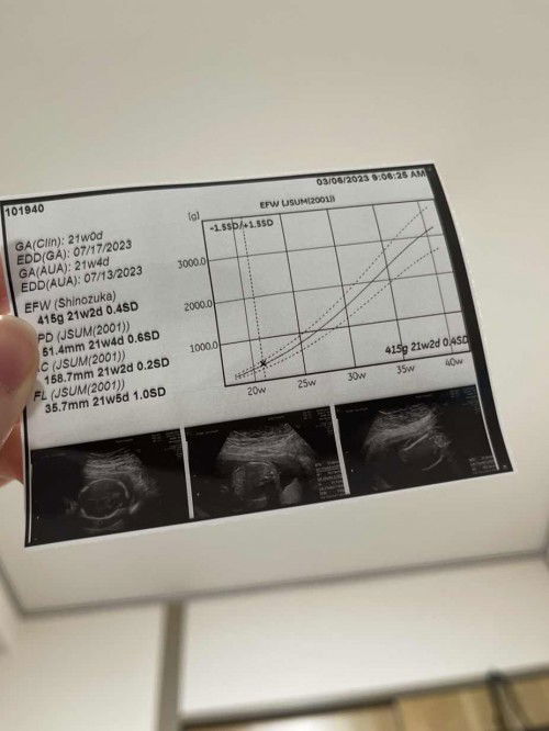 Ai nhìn  biết bé gái hay bé trai ko ạ