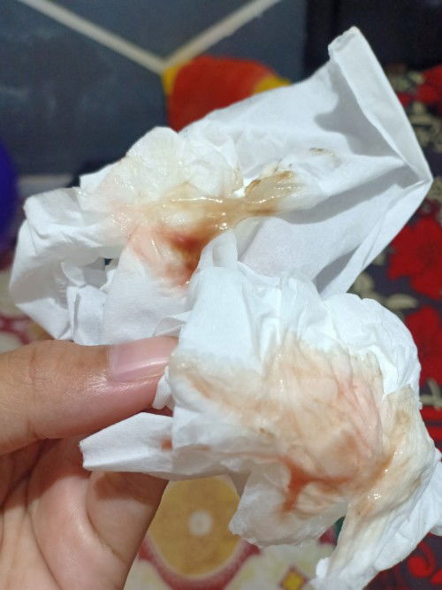 Keluar lendir merah coklat