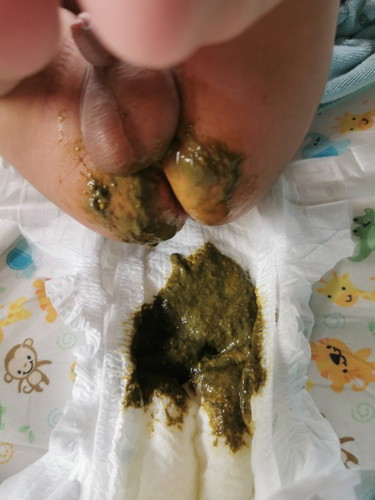 อึแบบนี้ปกติไหมค่ะแม่ๆ