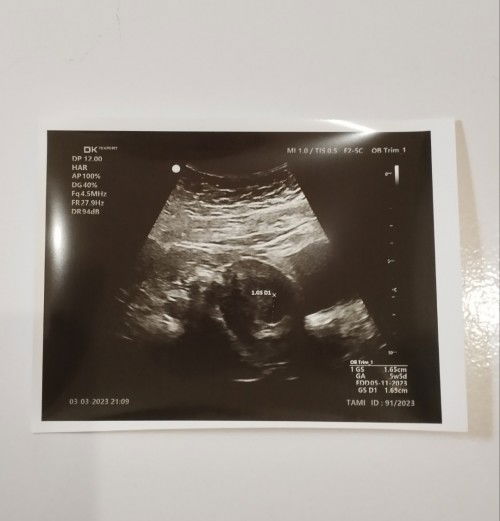 Ada yang sama gak bun??