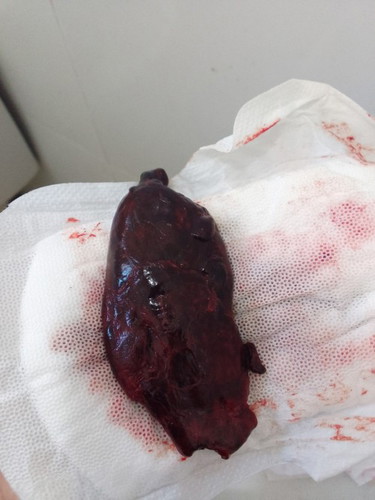 3days after givin birth