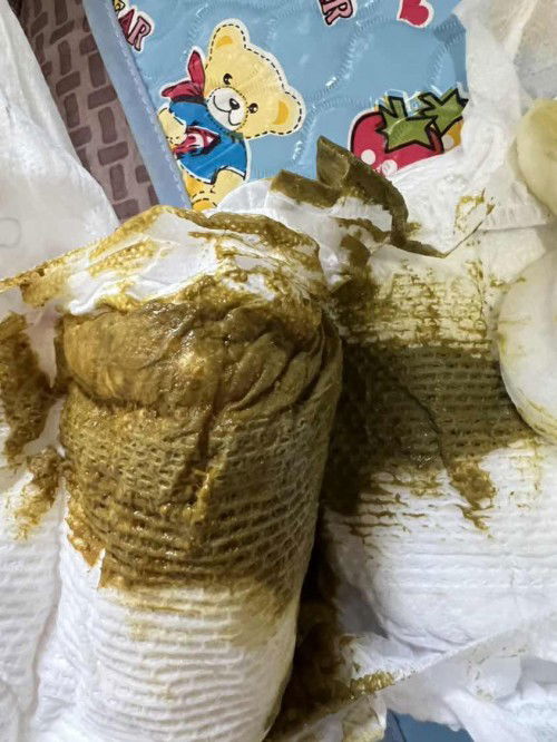 Dark Green Pupu ni LO