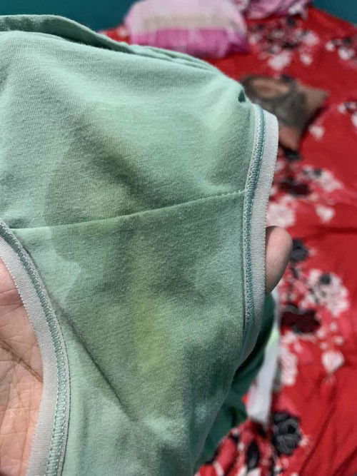 Bingung antara rembes air ketuban atau keputihan