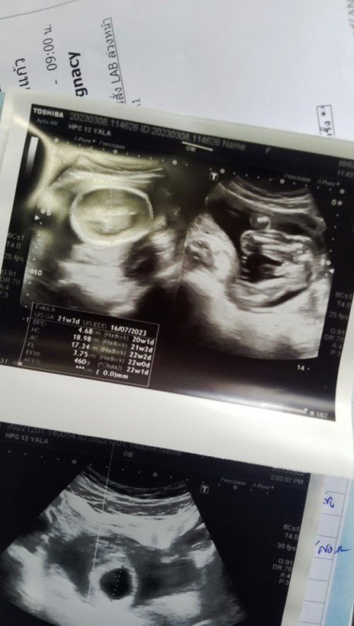 เเม่ๆช่วยดูให้หน่อยค่ะ ว่าน้องเป็นผช.ใช่ไหมคะ