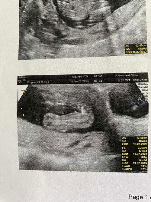 ช่วยดูหน่อยจ้า แม่ๆคิดว่าผญ หรือผช