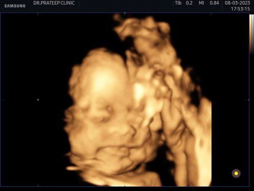 มาอวดภาพลูกน้อยของแม่ๆกันค่ะ