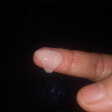 Keputihan normal atau tidak