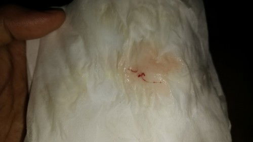 kluar darah saat keputihan