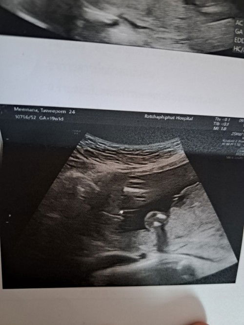 ช่วยดูเพศให้หน่อยค่ะ