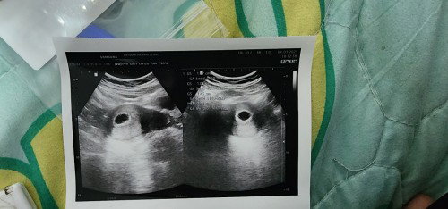 ได้เห็นรูปซาวด์ครั้งแรก