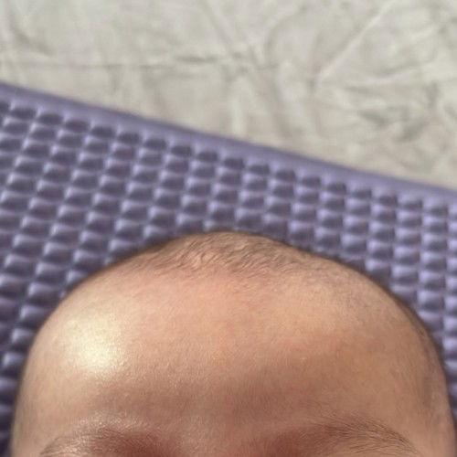 Ubun ubun baby timbul