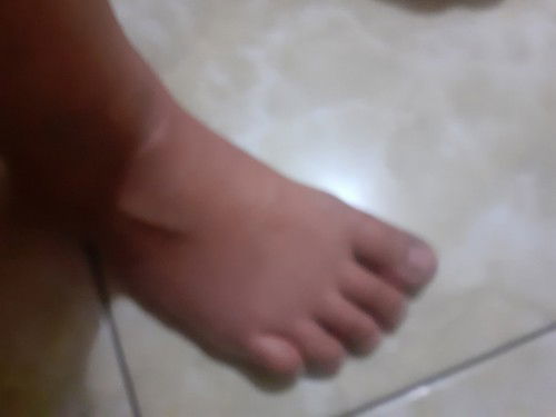 Kaki bengkak di 36wek