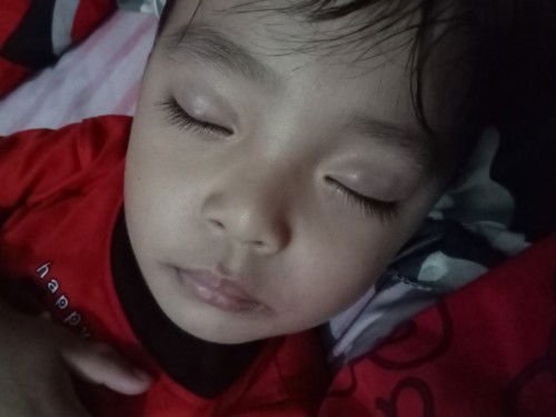 Bun ni kenapa ya kelopak mata anak saya ada benjolan kecil dua sma sebelah satu?