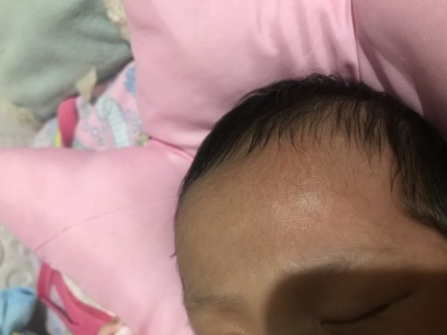 Baby Skin Care