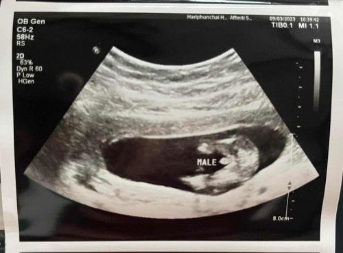 รู้เพศ 14W6D 🎉