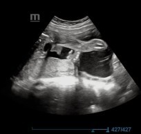 Sudah tau JK Baby Bunda"?