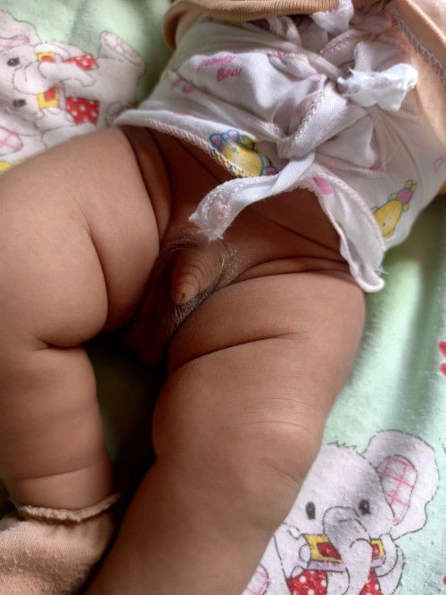 Kelamin bayi bengkak