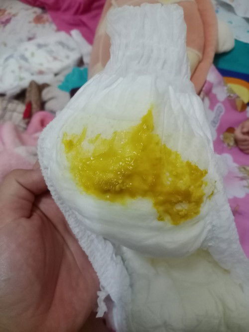 สอบถามแม่ๆหน่อยค่ะ