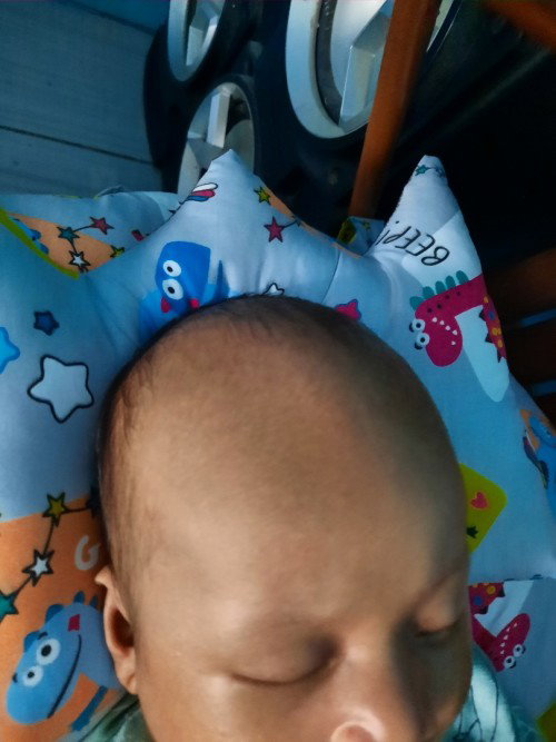 Rambut bayi rontok