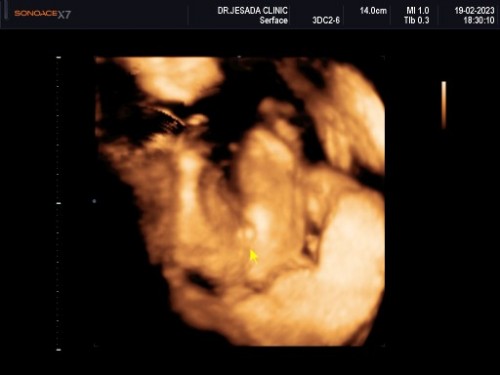 รูปนี้ เเม่ๆว่าเหมือนไข่ มั้ยคะ555