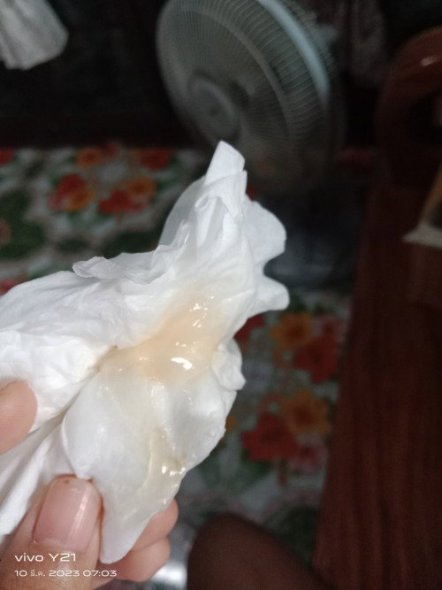 มีมูกสีน้ำตาล