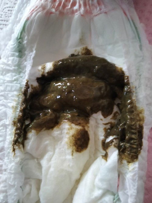 เปลี่ยนยี่ห้อนมผง