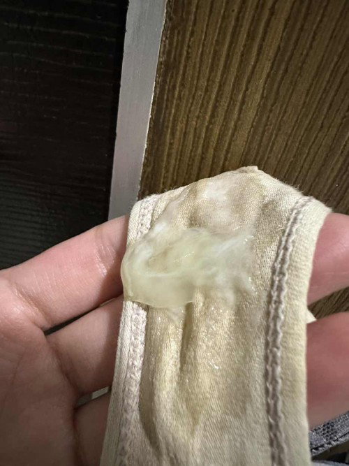 is this mucus plug?