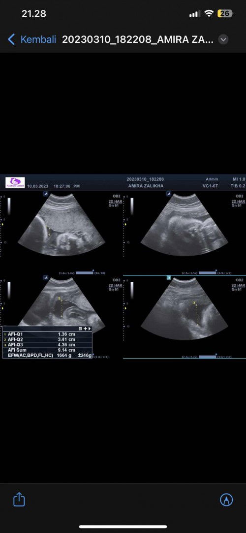 Ketuban sedikit grgr merembes atau kurang nutrisi ya?