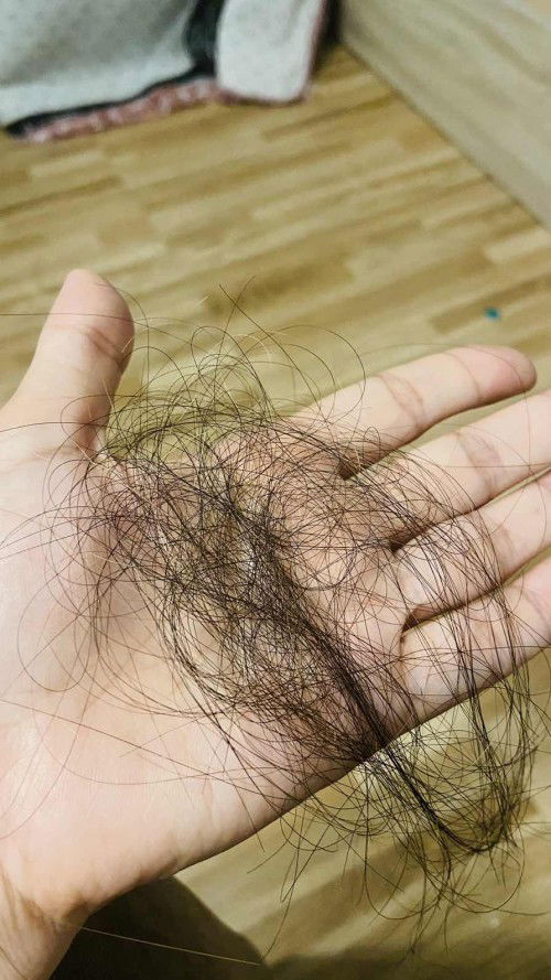 ช่วยแนะนำวิธีแก้หน่อยค่ะ