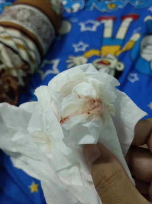 สอบถามแม่ๆค่ะ