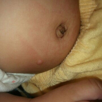 Assalamualaiakum bunda2.maaf sebelumnya.mau tanya cara ngilanginnya gmna ya bun ??