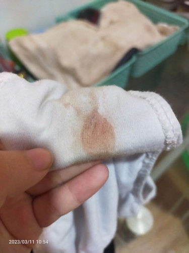 Pasensya na po sa picture pero pwde po bang mag ask if normal po ba na may lumabas na dugo sakin.