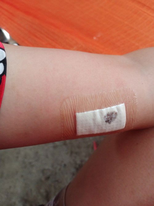 ขอสอบถามอาการหน่อยค่ะ