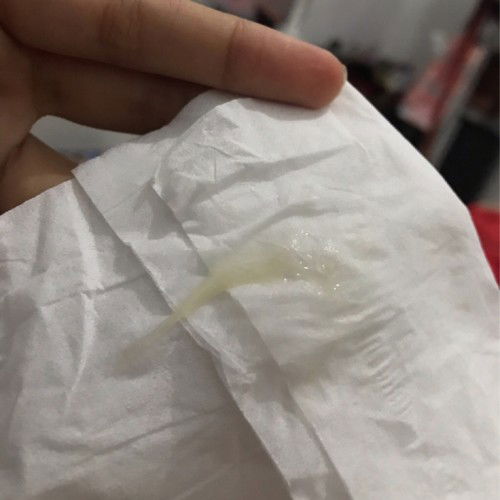 Keputihan di trimester 1