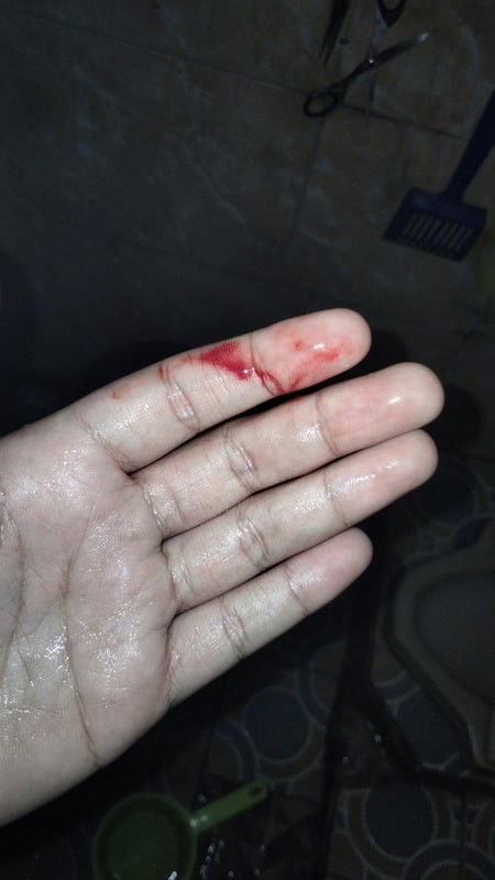 Keluar darah saat hamil muda