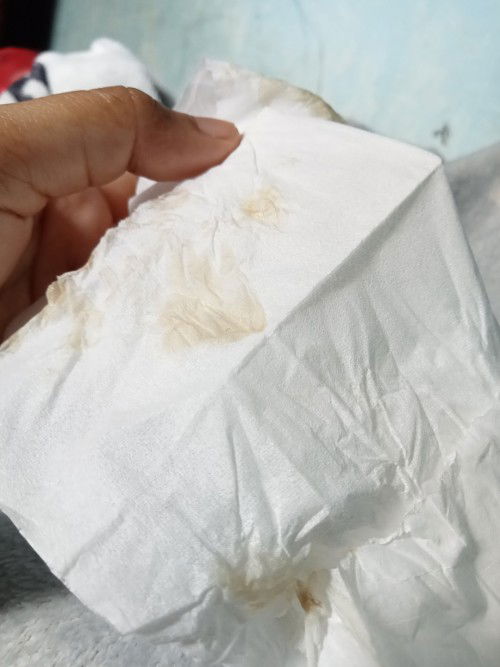 Bund dinisi ada yang pengalaman gak dari 7 sampe 8 w sering keluar lendir kuning kecoklatan tapi gak