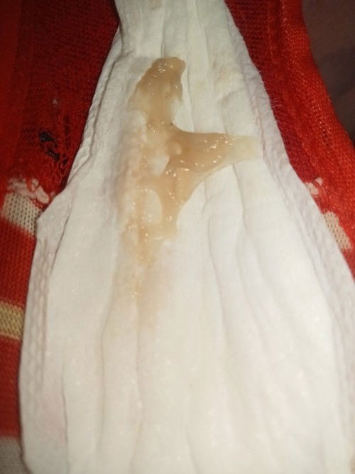 Hi mga Mommies ask lang po ako