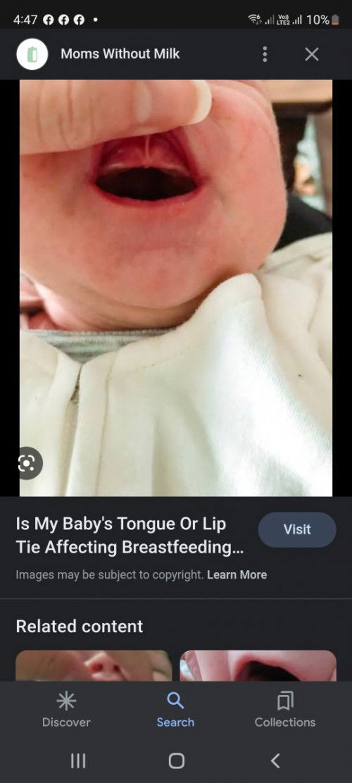 Approaching 4 months baby boy | Severely underweight | Pure breastfeed