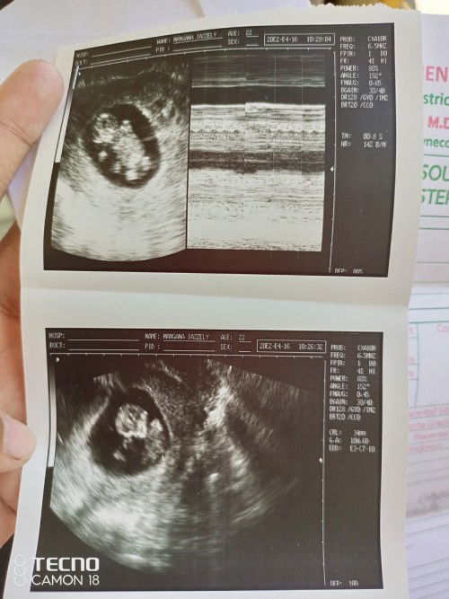 Healthy and active baby (10W 6D)
