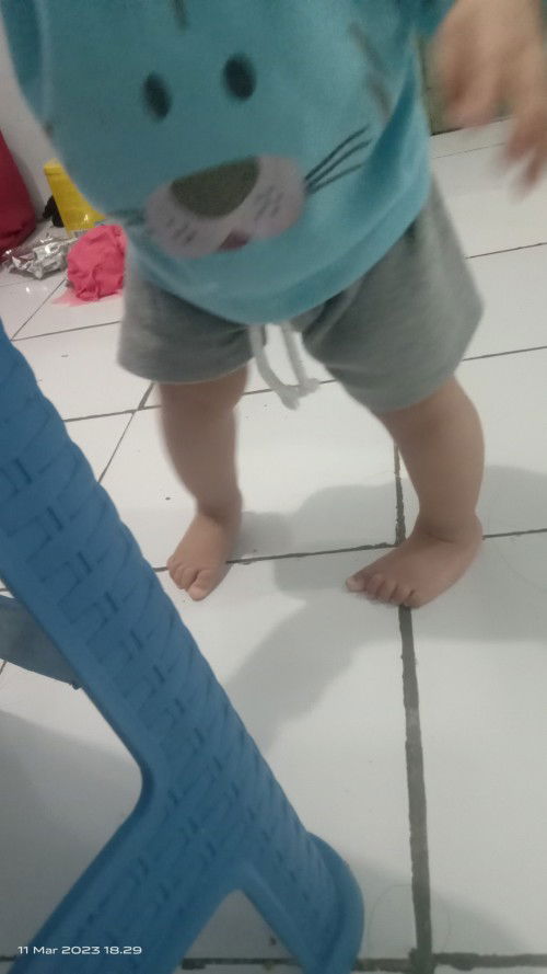 Bentuk kaki bayi