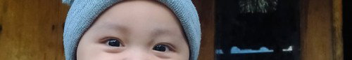 Mata juling pada bayi