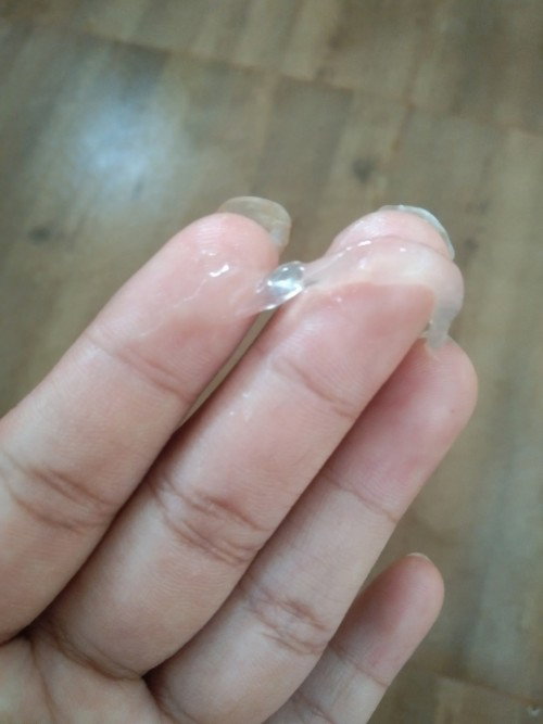 มีมูกใสออกมาแบบนี้ใกล้คลอดยังคะ