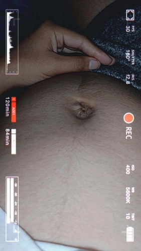 ask ko lang po kung normal po ba na mag 4months na akong buntis pero malambot pa din tummy ko?