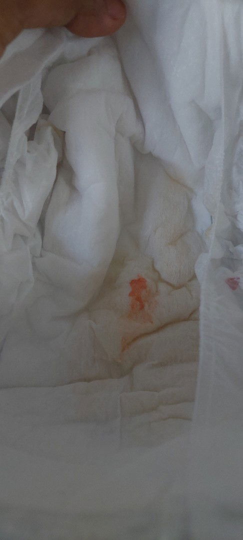 Pipis Bayi Newborn normalnya warna apa ya?