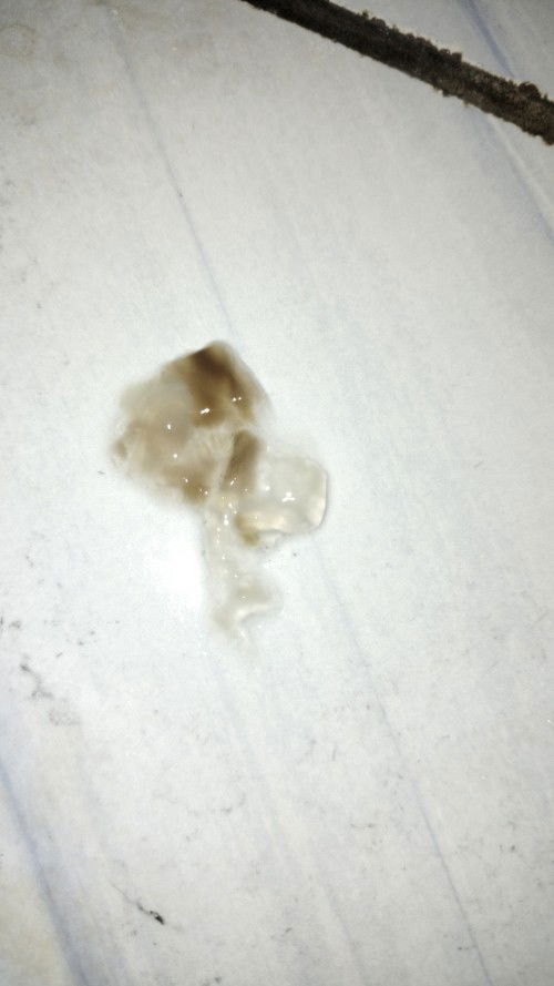 Kontraksi dan keluar lendir