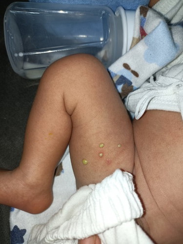 Mga mie anu kaya tung tumubo sa paa nang baby ko 20 days na po xa now .