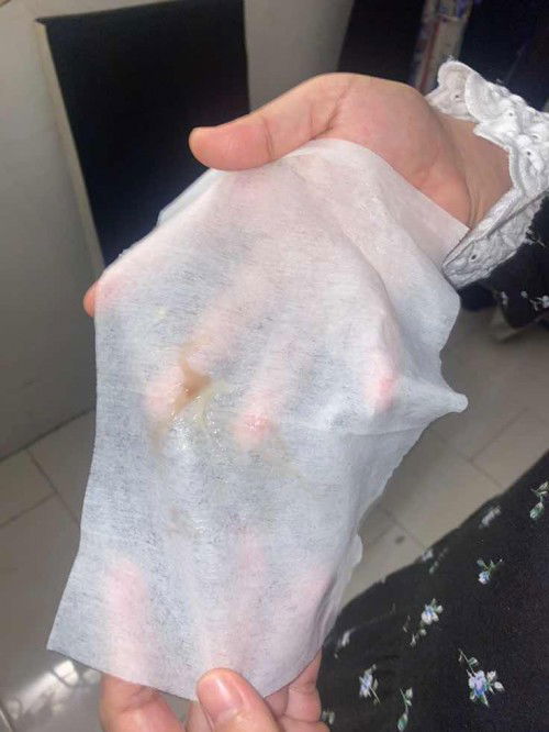 Php  di kandungan 38 week