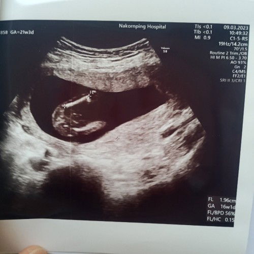 แม่ๆช่วยดูเพศน้องให้หน่อยคะ😊