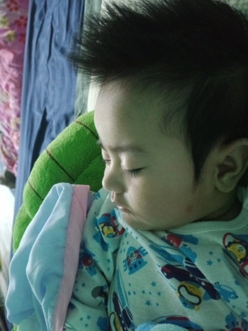 หน้าผสกน้องปูดบวมมั้ยคะ